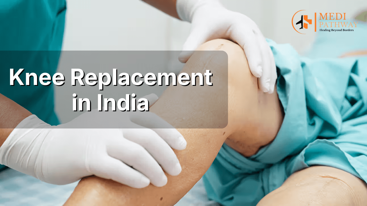 Knee Replacement in India