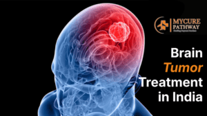 Brain Tumor Treatment in India