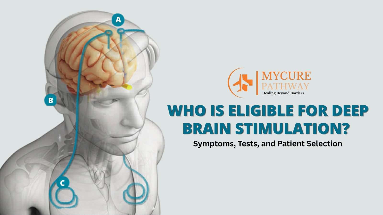 Deep Brain Stimulation Eligibility