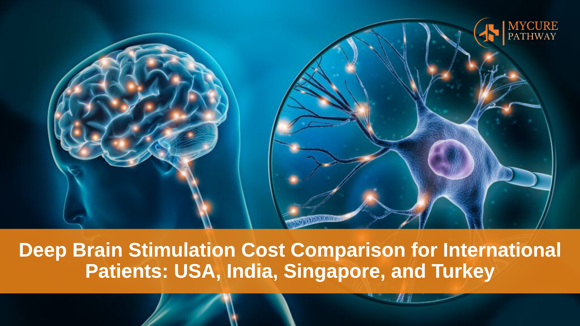 Deep Brain Stimulation Cost