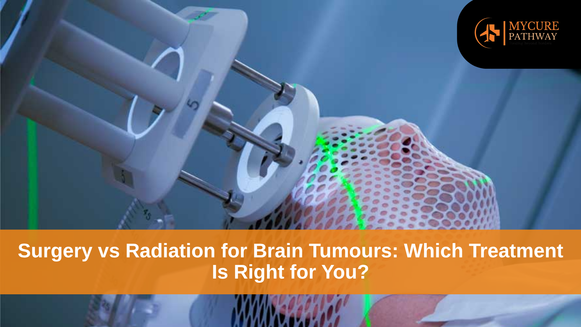 Surgery vs Radiation for Brain Tumours: Explained Guide