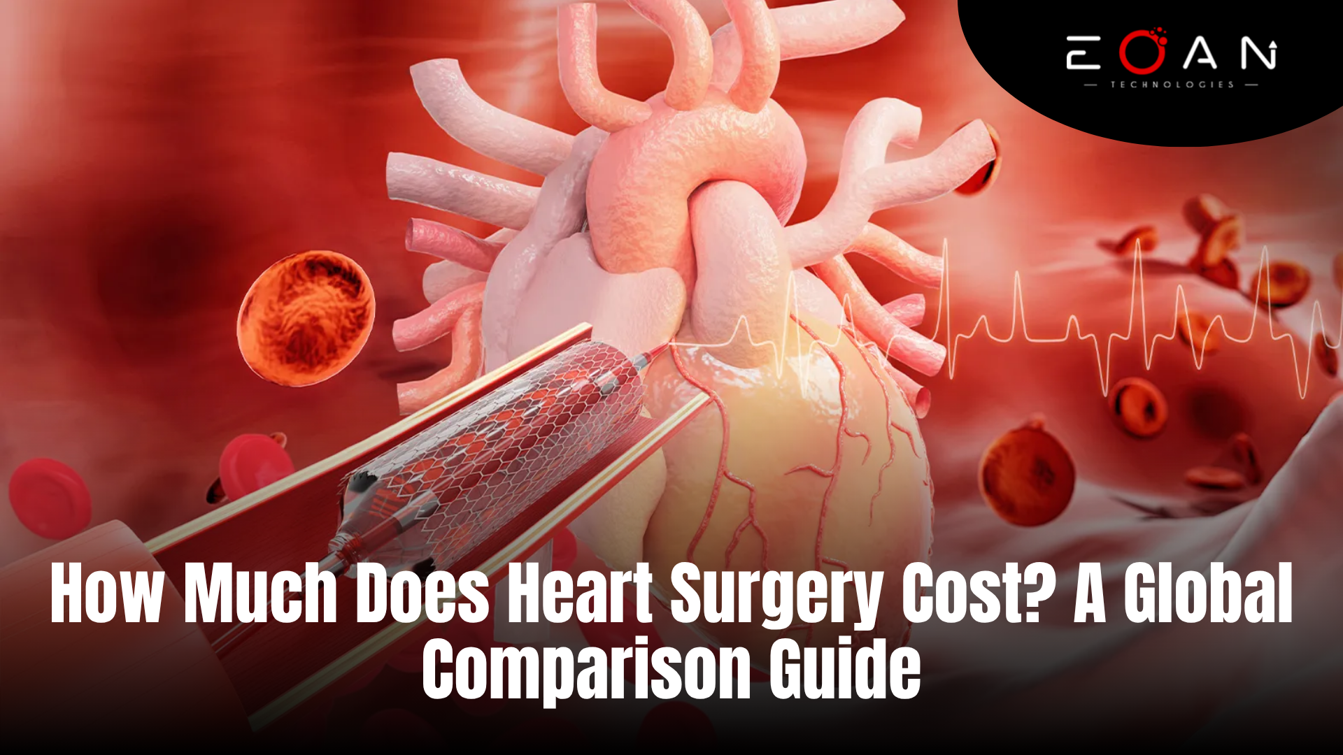 heart surgery cost