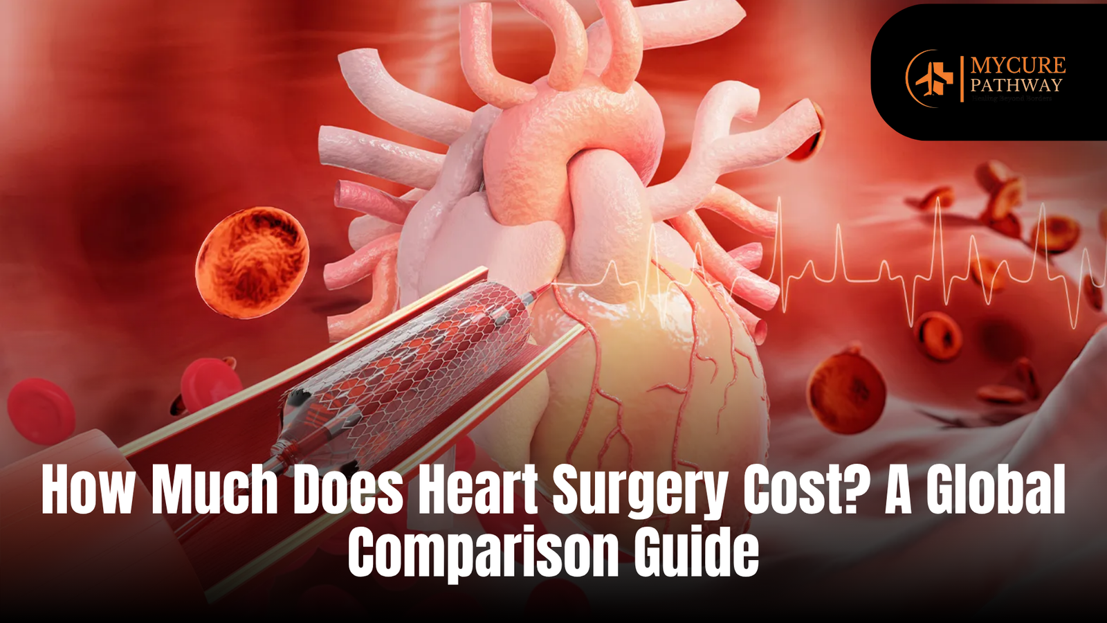 How Much Does Heart Surgery Cost? A Global Comparison Guide