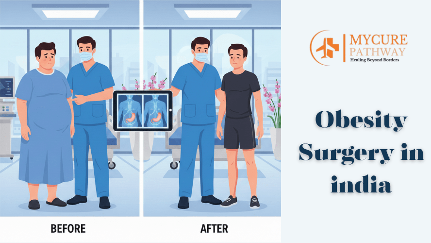 Obesity Surgery in India