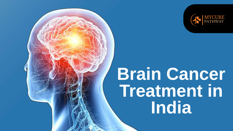 Brain Cancer Treatment in India
