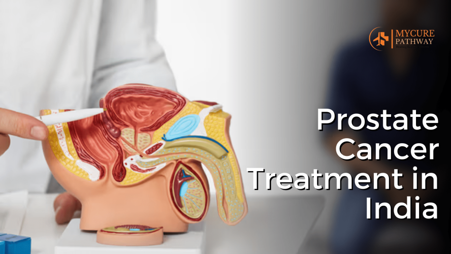 Prostate Cancer Treatment in India