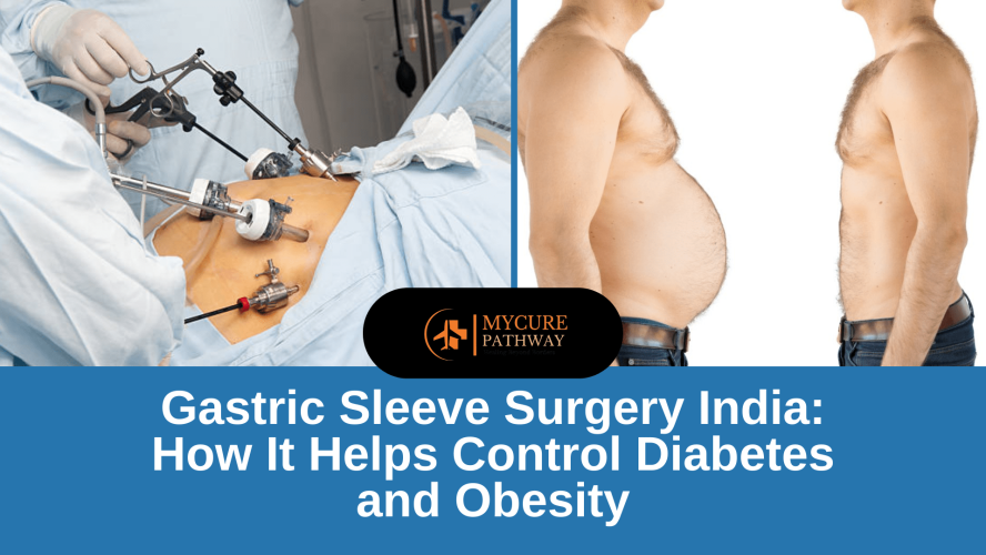 Gastric sleeve surgery India