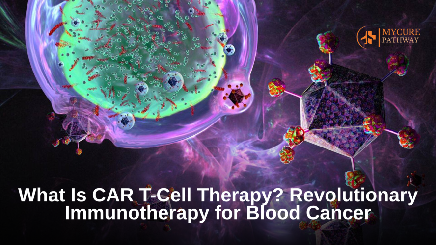 CAR T cell therapy